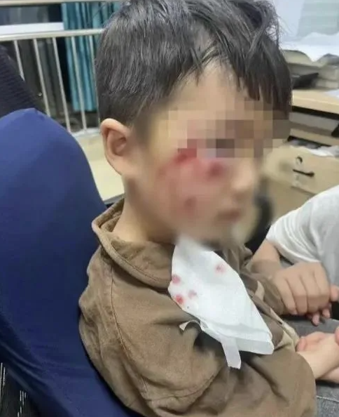 被瘋?cè)麤](méi)有“救命藥”，怎么辦？